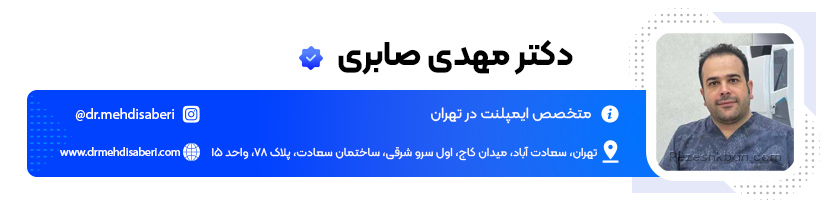 دکتر مهدی صابری پزشک ایمپلنت دندان در تهران