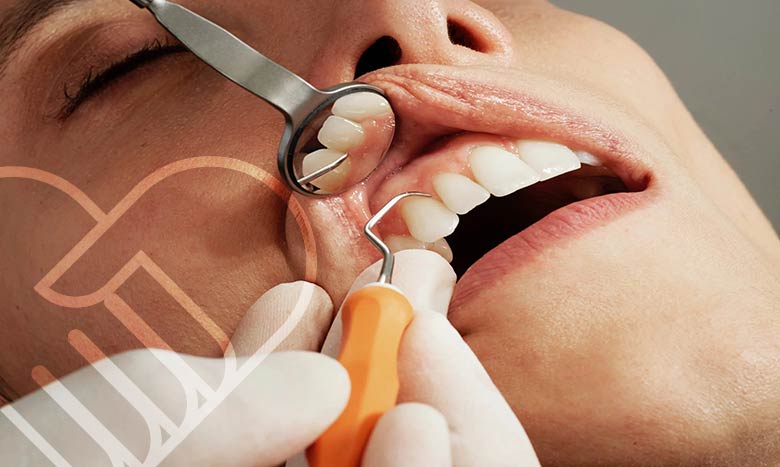 چگونه بهترین متخصص ایمپلنت را پیدا کنیم؟