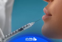 معرفی بهترین دکتر بوتاکس - بهترین کلینیک بوتاکس