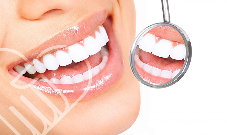 مزایای لمینت سرامیکی