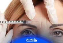 تزریق بوتاکس پیشانی