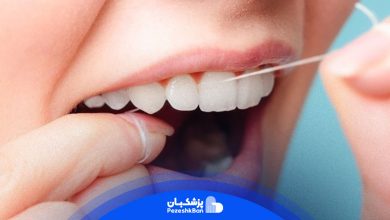 تفاوت-نخ-دندان-ارتودنسی-با-معمولی-چیست؟