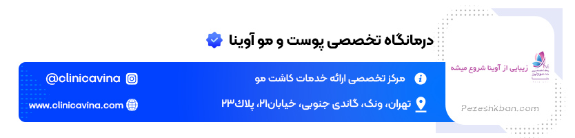 درمانگاه تخصصی پوست و مو آوینا؛ کلینیک کاشت مو