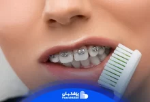 عوارض سیمکشی دندان