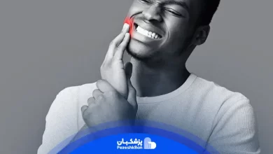 آبسه دندان چیست و چه علل و عواملی دارد و چطور آن را درمان کنیم؟