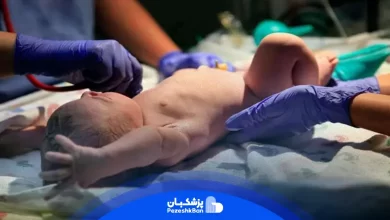 ادرار بعد از ختنه نوزاد؛ علت و راه حل ها