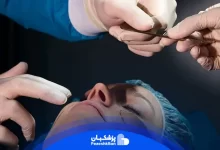 لیست بهترین جراح بینی طبیعی در تهران