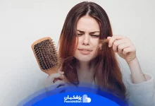 دلایل ریزش مو چیست؟