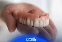 هزینه دندان مصنوعی برای افراد جوان