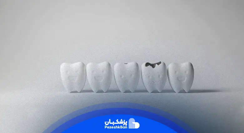 علائم عفونت دندان کدام‌اند؟