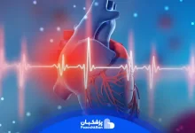 علائم سکته قلبی چیست و نحوه تشخیص آن