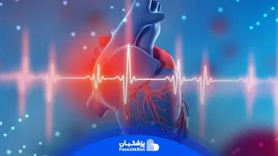علائم سکته قلبی چیست و نحوه تشخیص آن