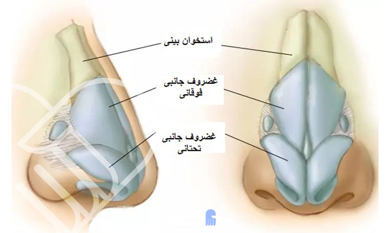 شکستگی بینی