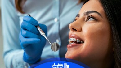 ارتودنسی دندان چیست و چه انواعی دارد؟