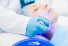 مراحل انجام آر اف فرکشنال (RF)