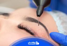 بهترین سن برای عمل بلفاروپلاستی چه زمانی است؟
