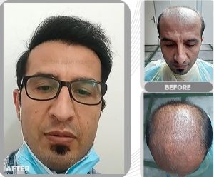 نمونه کار تهران بیوتی 6