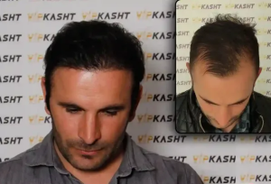 نمونه کار vipkasht 2