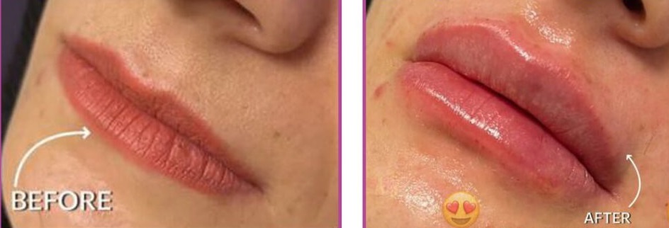 نمومه کار 2avina
