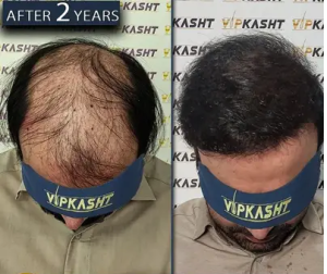 نمونه کار vipkasht 1