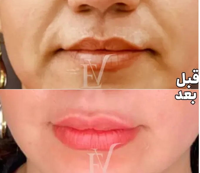نمونه کار کلینیک تخصصی پوست و مو ایوا