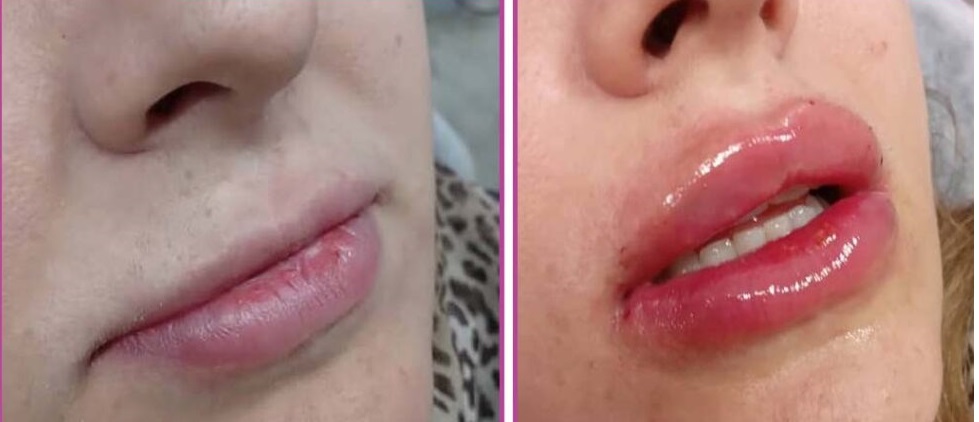 نمومه کار 2avina