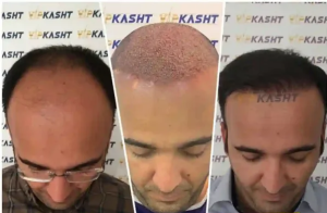 نمونه کار vipkasht 3