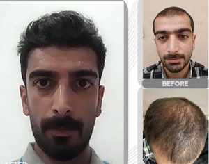 نمونه کار تهران بیوتی 2
