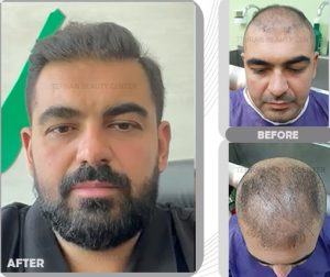 نمونه کار تهران بیوتی 1