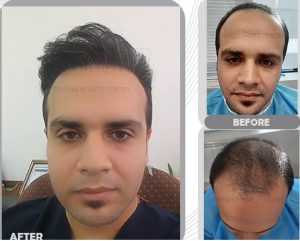 نمونه کار تهران بیوتی 5