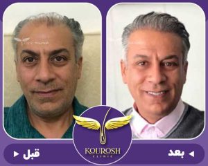 نمونه کار kooroshclinic2