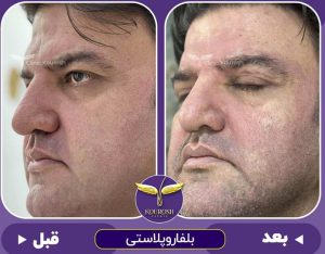 نمونه کار kooroshclinic