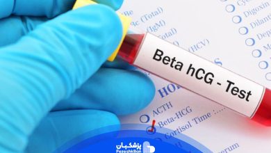 آزمایش بتا بارداری