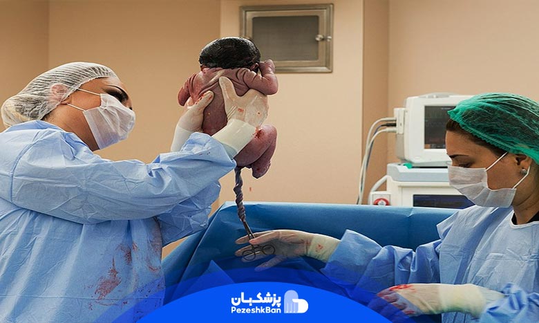 زایمان طبیعی یا سزارین